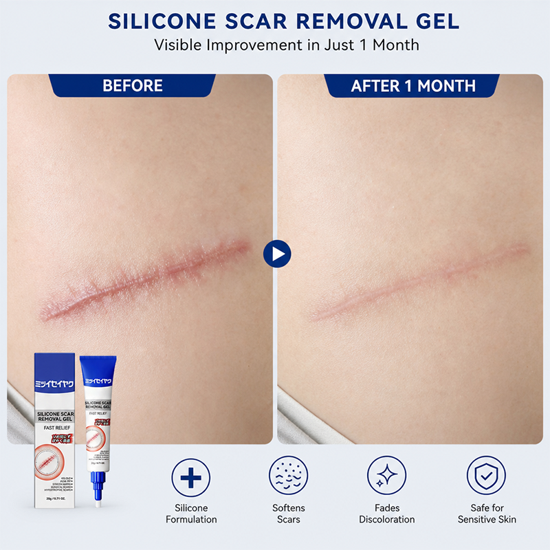 Advanced Silicone Scar & Wrinkle Smoothing Gel ๐งด