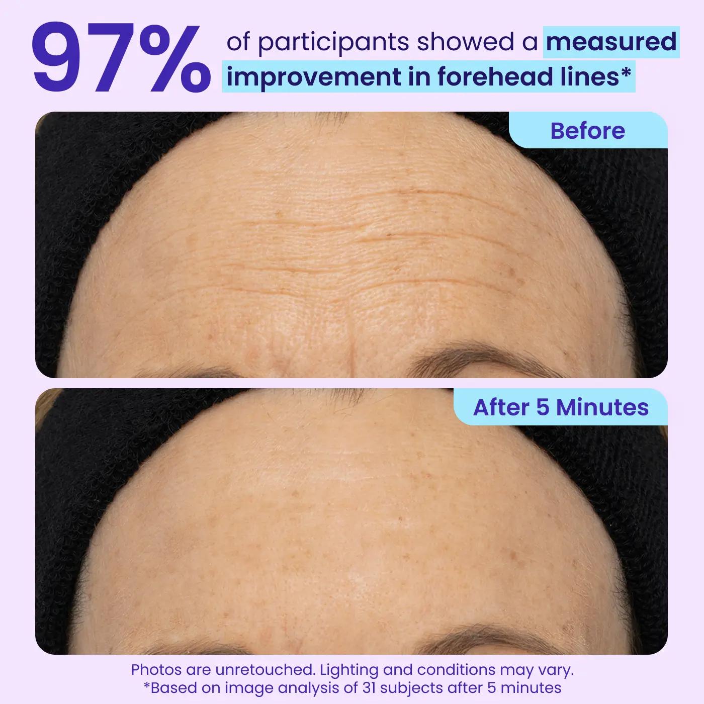 NEW! Instant Lift Eye Gel - For Puffiness & Bags, Wrinkles