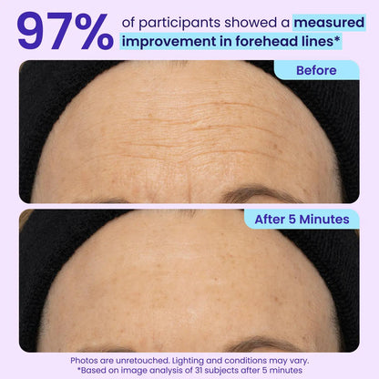 NEW! Instant Lift Eye Gel - For Puffiness & Bags, Wrinkles