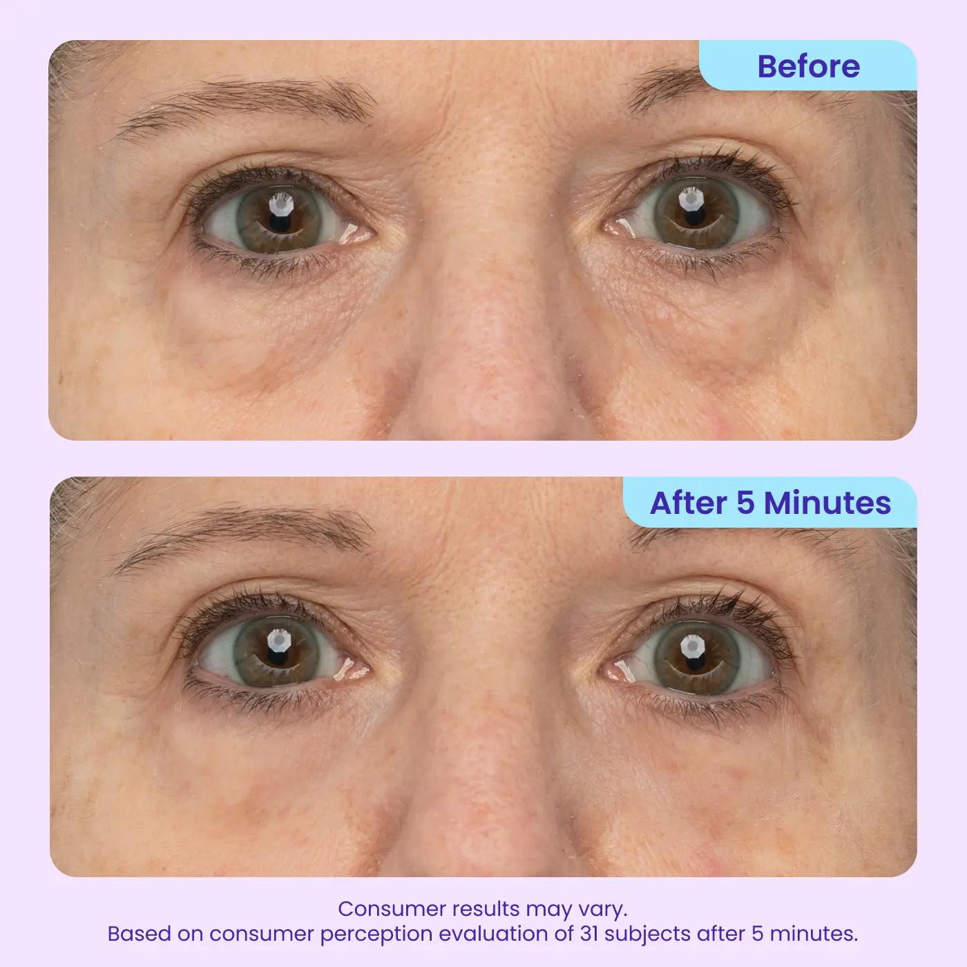 NEW! Instant Lift Eye Gel - For Puffiness & Bags, Wrinkles