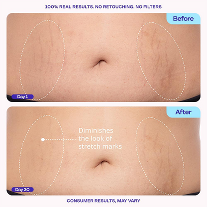 Tighten & Smooth Belly Cream, MicroTight4 Complex Body Firming Lotion for Loose Skin💜