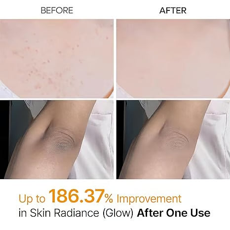 [Dr.Malex Official] 200ml Peel Shot Keratin Care Kojic Acid Turmeric Spray ✨