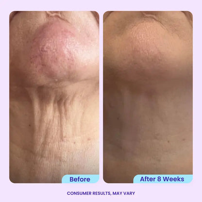 Tighten & Smooth Belly Cream, MicroTight4 Complex Body Firming Lotion for Loose Skin💜