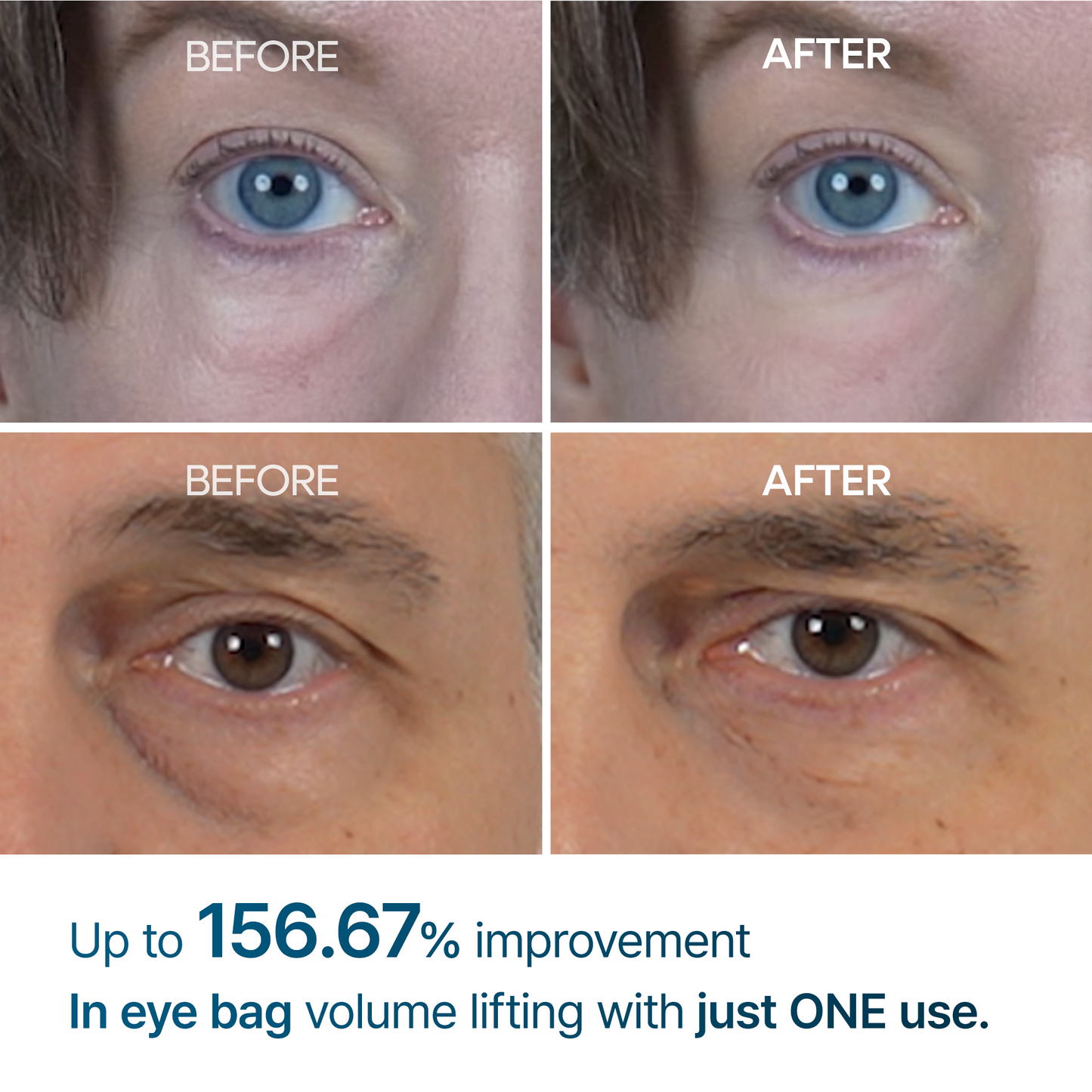 Eyephalt Eye Cream-Resurface Your Eyes Instantly 👁️