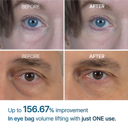 Eyephalt Eye Cream-Resurface Your Eyes Instantly 👁️