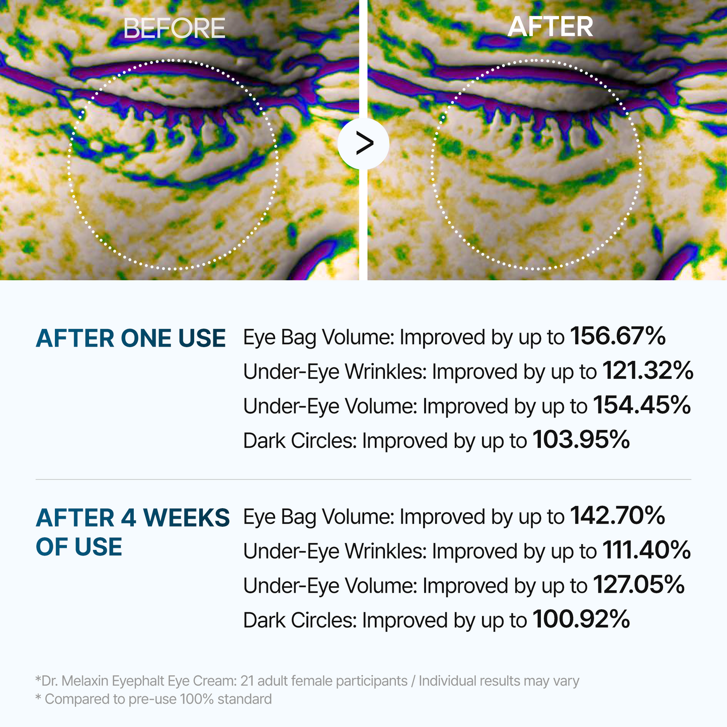 Eyephalt Eye Cream-Resurface Your Eyes Instantly 👁️