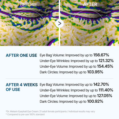 Eyephalt Eye Cream-Resurface Your Eyes Instantly 👁️