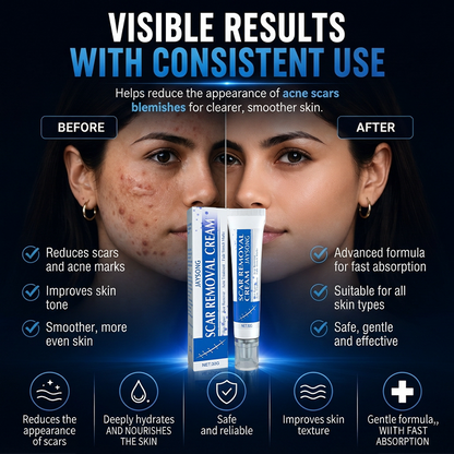ScarSmooth™ – Great Care Cream for All Types of Skin Marks 🧴
