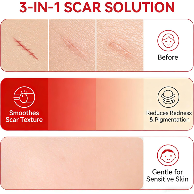 Advanced Silicone Scar Cream - Skin Repair Treatment for Surgical Acne Scars🩹
