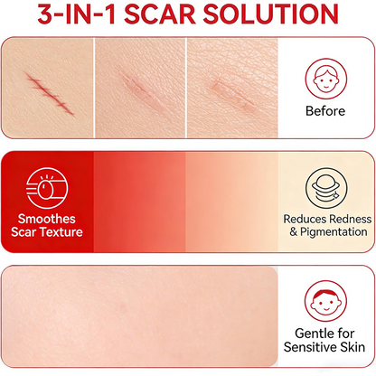 Advanced Silicone Scar Cream - Skin Repair Treatment for Surgical Acne Scars🩹