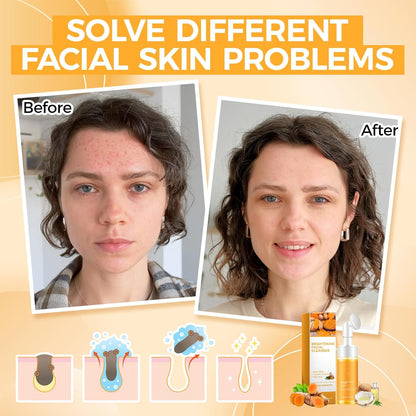 Deep cleansing Turmeric Brightening Facial SkincareCleanser, Comfort Deep Cleansing🧴