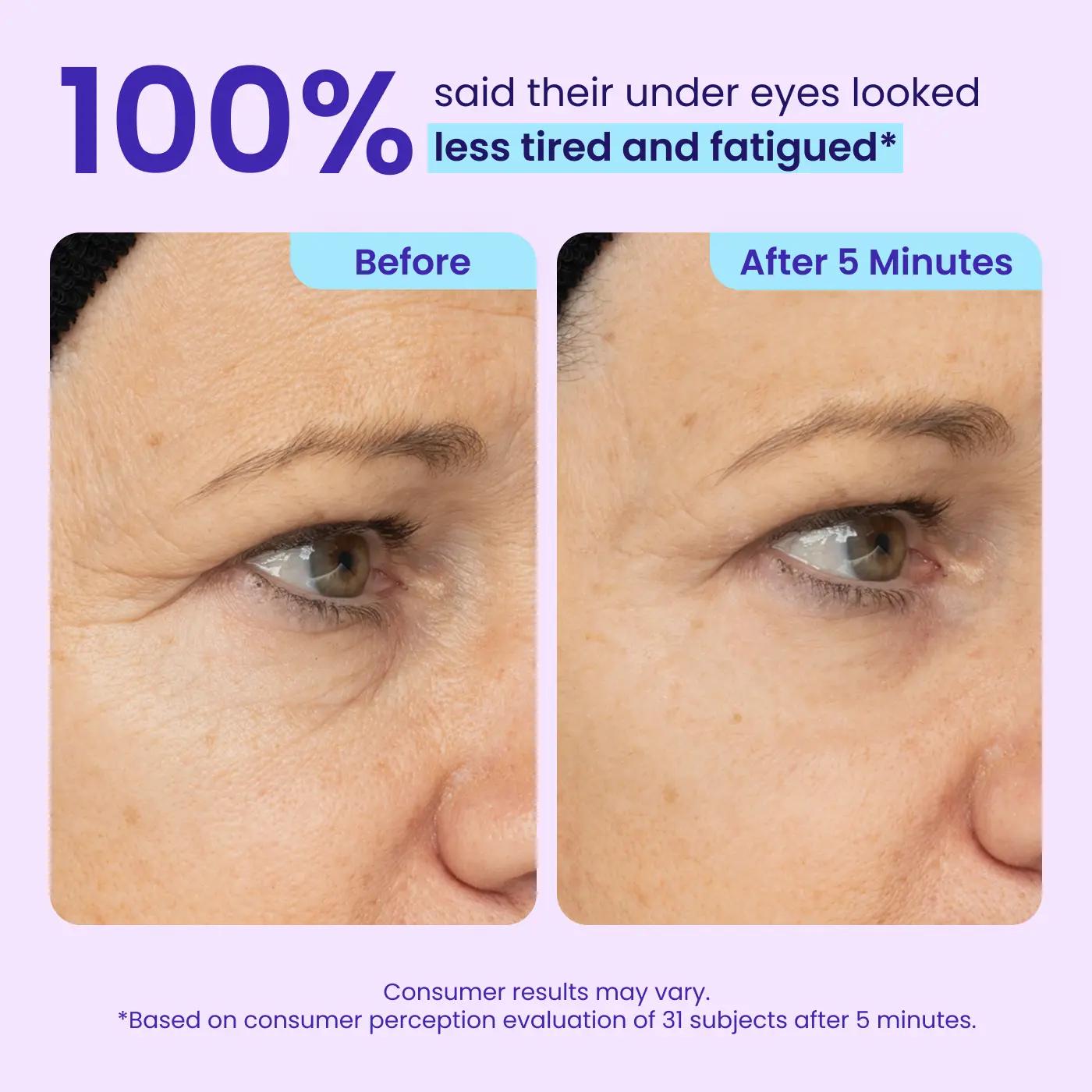 NEW! Instant Lift Eye Gel - For Puffiness & Bags, Wrinkles