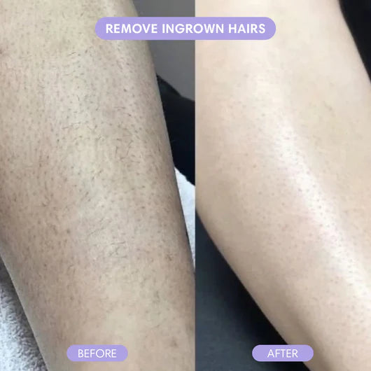 Bikini Pain-Free Hair Removal Cream for Sensitive Skin