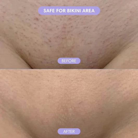 Bikini Pain-Free Hair Removal Cream for Sensitive Skin