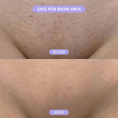 Bikini Pain-Free Hair Removal Cream for Sensitive Skin