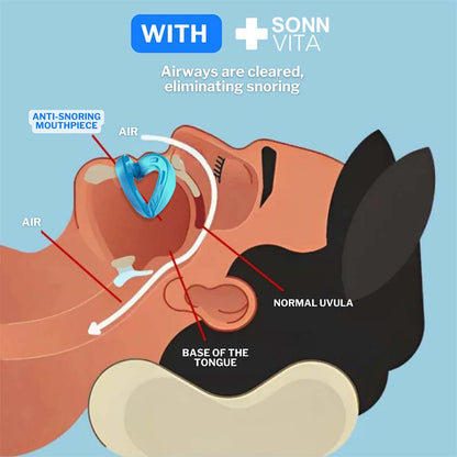 Comfortable Anti-Snoring Device, Nighttime Sleep Aid💤