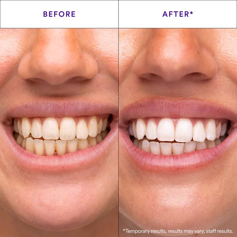 V34 PAP+ Teeth Whitening Strips | Peroxide-Free Gentle Yellow Tone Correction🦷