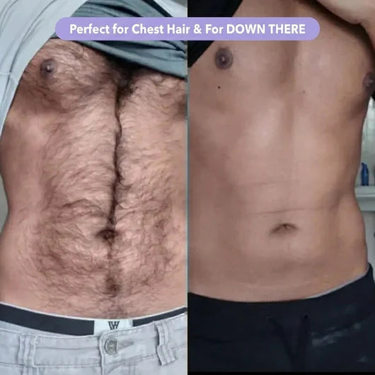 Bikini Pain-Free Hair Removal Cream for Sensitive Skin